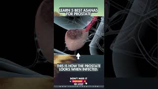 Fruits to Shrink Enlarged Prostate [upl. by Vivyan73]