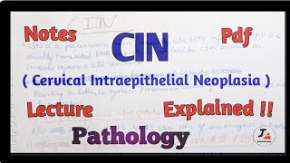 Cervical Intraepithelial Neoplasia CIN Pathology [upl. by Allerus685]