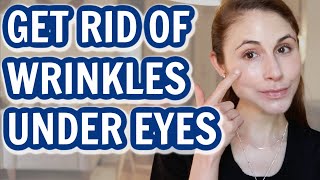 How to GET RID OF UNDER EYE WRINKLES Dr Dray [upl. by Sarette]