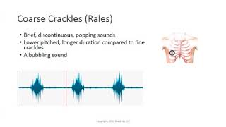 Coarse Crackles Rales  Lung Sounds  Medzcool [upl. by Ainalem252]