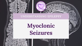 What are Myoclonic Seizures [upl. by Llohcin]