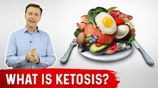 What is Ketosis  Dr Berg [upl. by Ellevart]